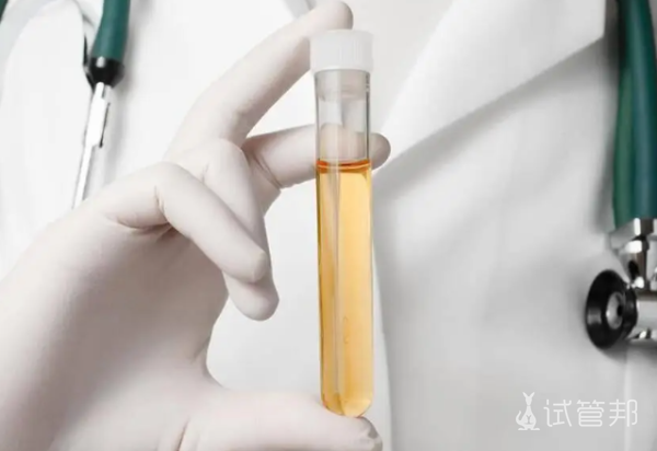 50b4763c921ba1957f1f17a3621d76c6.png 尿道炎经常复发怎么回事