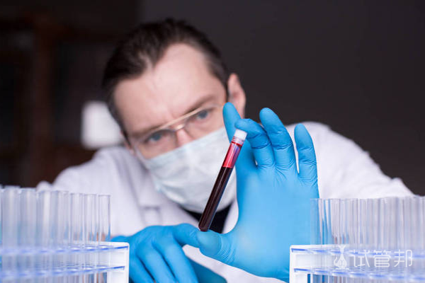 d187c65800554d2f86133b6bcb5c9080.png 血沉高什么原因导致的