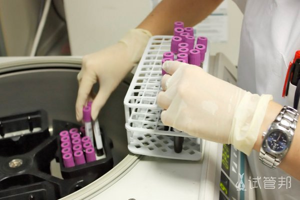 e1c6790b09e1def1528caeaa7b9d0f73.png 血沉是化验什么的