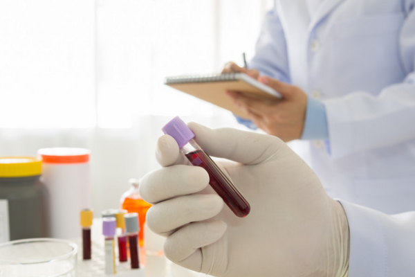 0e29ad43ed2c3bb407a19f325b3a92a0.png 血沉和类风湿因子是一样的