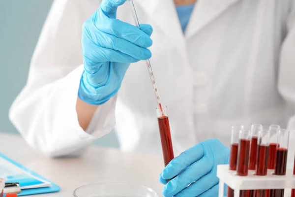 342e30c35212736f01969542882ebc61.png 血沉高会不会影响怀孕