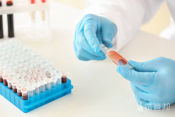 6b8f923cd3839cf5dc3b767534465486.png 血沉能检查哪些疾病