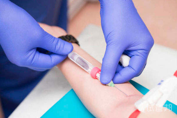 d32f61cf49638981b36ff3aadb2f23a3.png 血沉高怎么回事