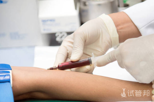 2108f102df9bdd4b26fc071ea11903c5.png 血沉高是什么表现