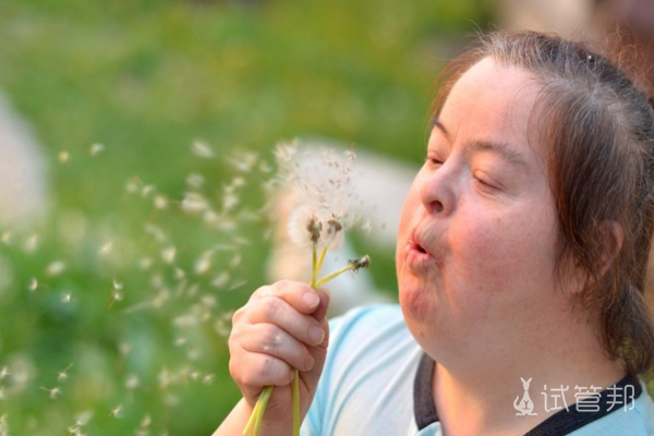 4e741d47eb5ea59b73c3366e378c537d.png 唐氏综合症是什么意思