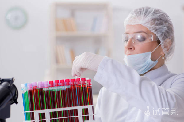 99472de7fdd8179f68a439b0ad53e53f.png 血沉正常值参考范围是多少