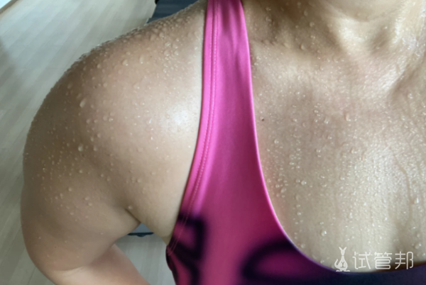 d4eafc409087b7784816de3d529e30c2.png 查性激素六项雌二醇过高怎么办