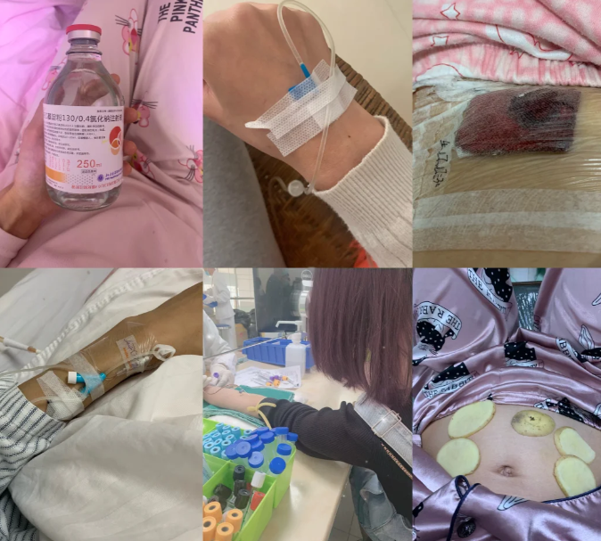 0a7b23cac7484d920adb2bd3c86afa53.png 我的试管之路怎么这么波折啊