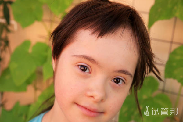 171056fdb326a580fd6d3340288980f7.png 唐氏综合症高风险该怎么办