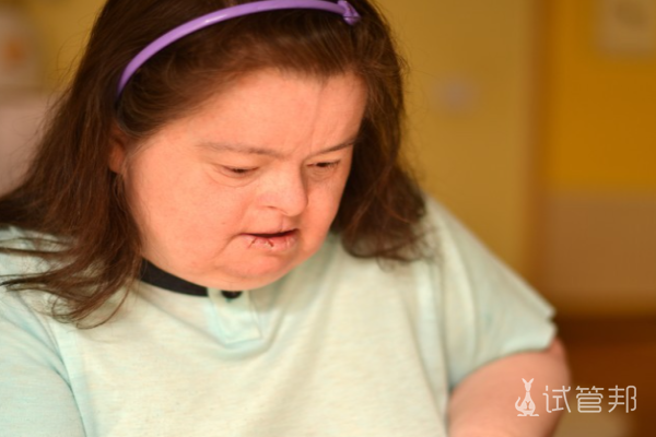 d36f3d79b52450c65e157a2f2c6c0a26.png 唐氏综合症孩子智商是多少