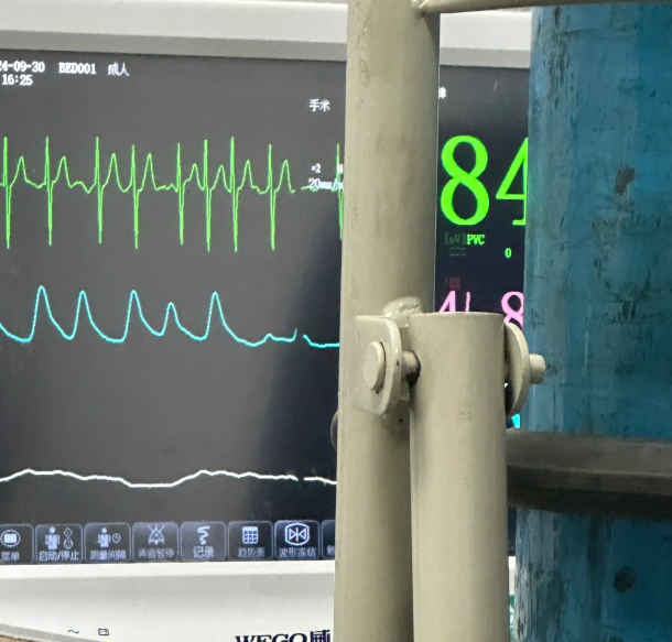 665c946c5a9ce4bade884b257a05f0ec.png 吃了辅酶q10以后犯房颤了