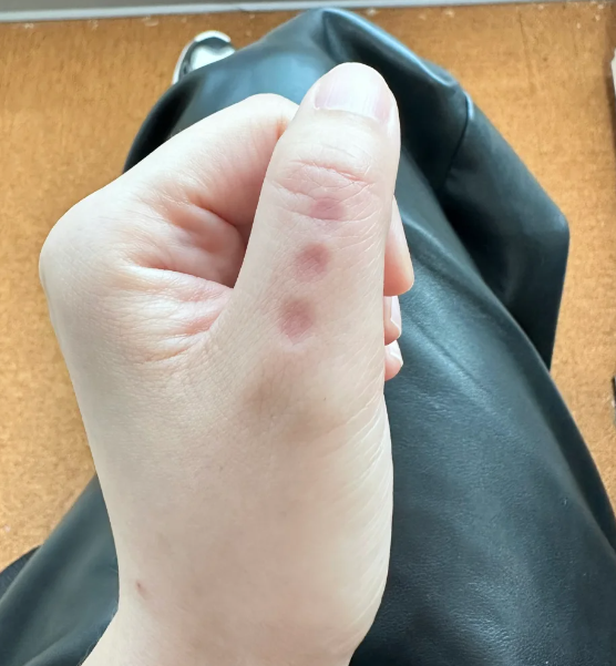 月经推迟别急可以试试我的催姨妈大法