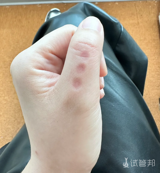 8ace875064de9f72e274bdf51883b779.png 月经推迟别急可以试试我的催姨妈大法