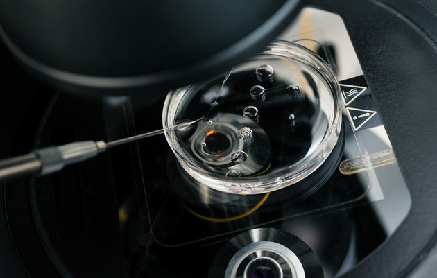 b390edb168f78776ba50cf2df47b9dec.png 试管婴儿的全部流程及注意事项