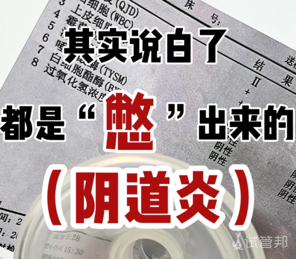 94a1810b8fe4329f363923791cb3757e.png 阴道炎居然是这么来的