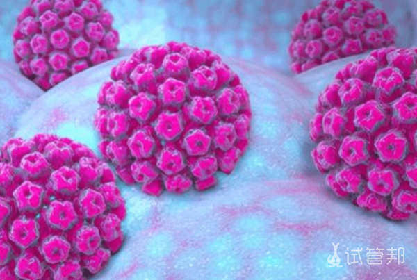 06cf295da36db7554a2d8d95aa13bdb3.png 人乳头瘤病毒能治愈吗