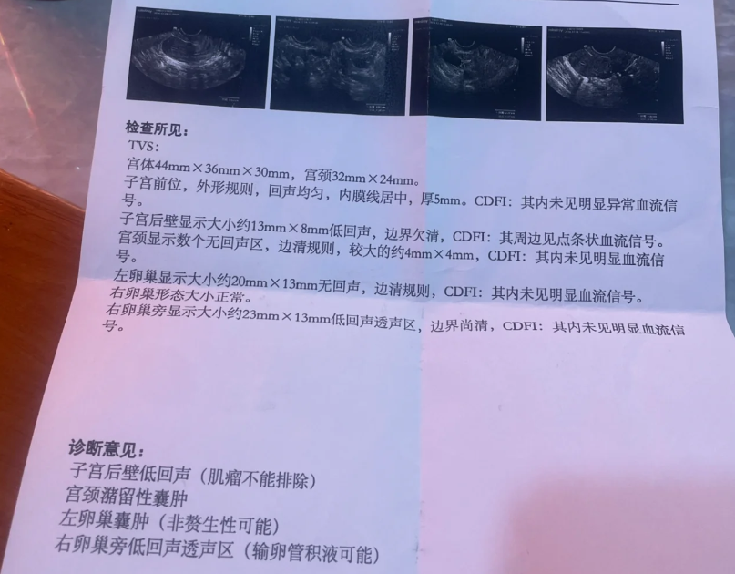 输卵管积水又复发了