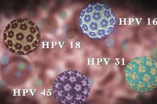 6170897f60746cf4b56e812ea46bfc4a.png 人乳头瘤病毒58型阳性可以同房吗