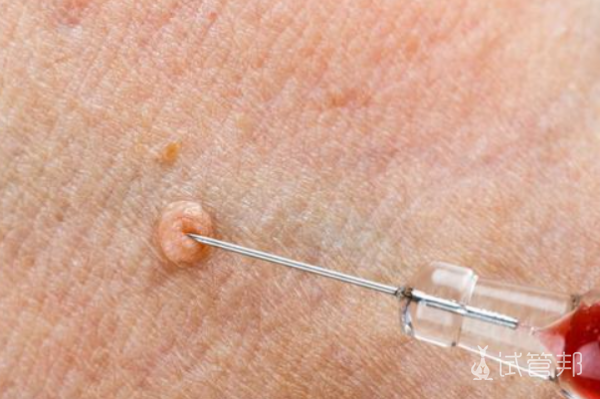 76d9c6be2431fa9e9b94ccc4e2bd81a9.png 人乳头瘤病毒图片