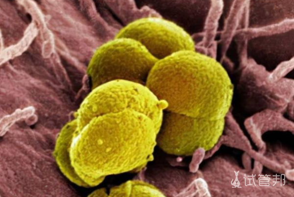 791b2f42461f024bf4cfefe6aa27478c.png 人乳头瘤病毒是什么