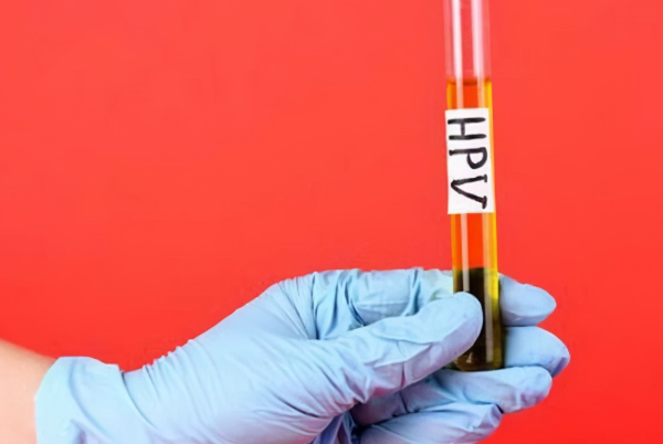 9ec971129fcb312e22fc146e535ee2ce.png 人乳头瘤病毒53型阳性是什么意思