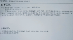 输卵管积水别太焦虑，试管婴儿顺利上岸