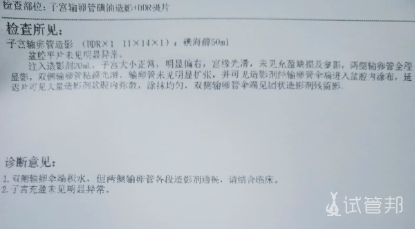 b797205ba35aaa832d10ab540aac16cd.png 输卵管积水别太焦虑