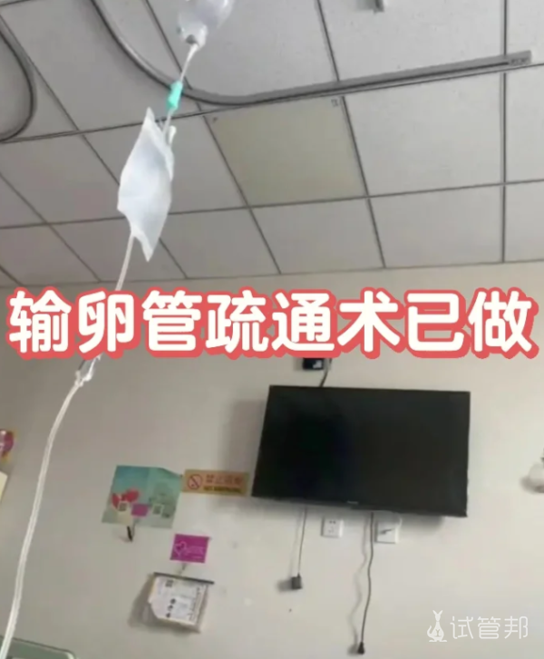 bcb2276f7dbfe14ee2be81c7e7e12b65.png 输卵管积水的手术疏通经历分享