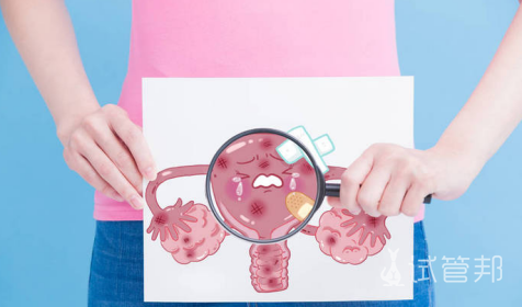 c331d6b745ecc51781da12745967b211.png 子宫腺肌症的治疗方法有哪几种