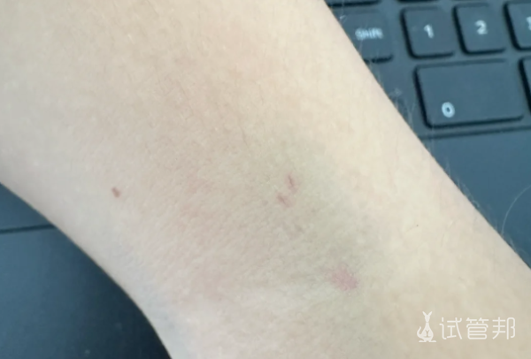 f41f9c0a5870636b26316a82609e20b5.png 备孕之路我终于搞懂了人授与试管的那些事儿