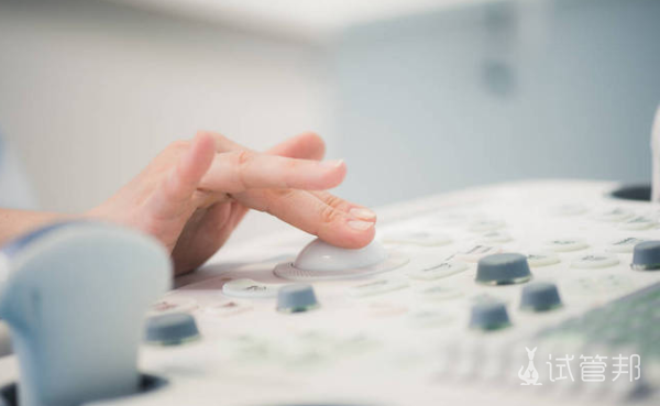 01ef066040bec9e228e37061205d1dfd.png 四维彩超可以看出男女吗