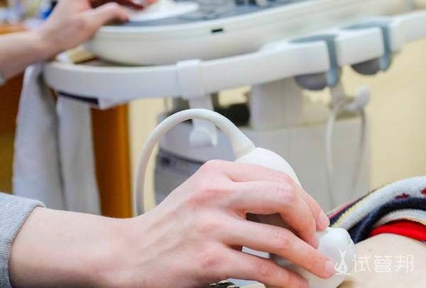 5508d316384d6b2945652a791f28fb19.png 四维彩超什么时候做最好