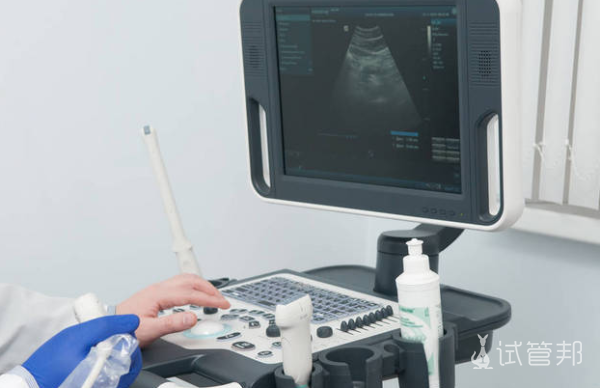 5f3e0a1a6caf4f2947048c9ad518179a.png 四维彩超检查什么时候出结果