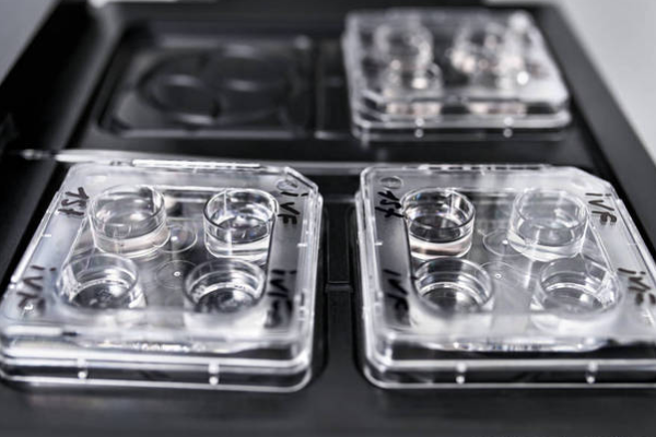 e23eccf9682eeca5fa5ff275a0522417.png 试管婴儿有哪些常见类型