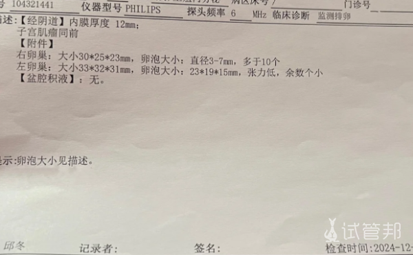 544db5a7530089a7368409d0e835e0c8.png 宫腔镜术后卵泡监测有哪些注意事项