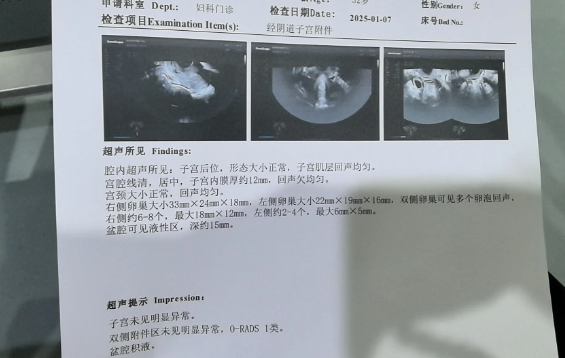 第一次做卵泡监测需要怎么做