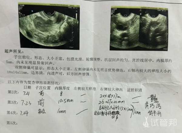 3a5202505e4b17be9bfadafd640256fe.png 以为卵泡黄素化了没想到排出来了