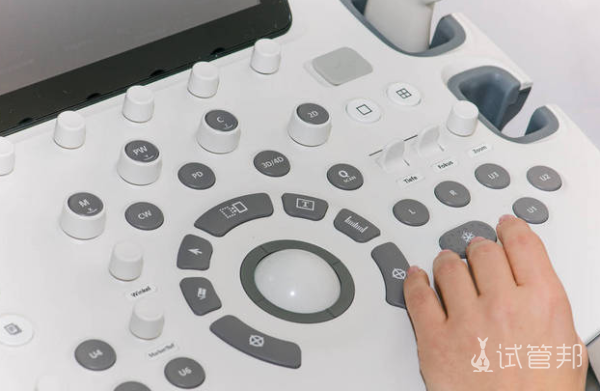 a3b5feded79e6dc740cd73da3cb398b3.png 卵泡监测怎么检查