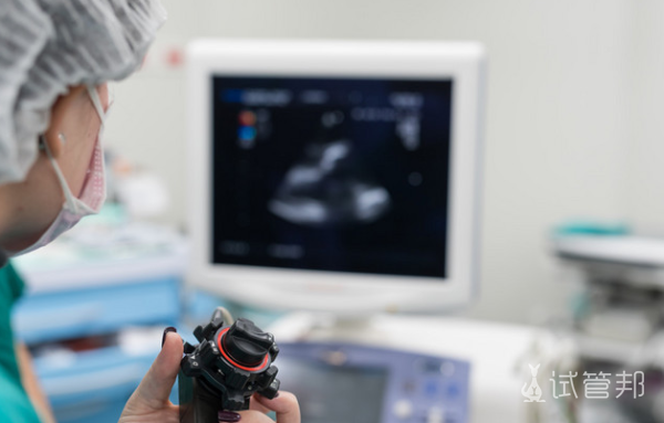 e12896c889fa7fa0807498863a9841c9.png 监测卵泡可以刷医保卡吗