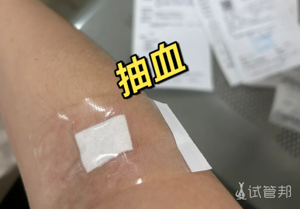 405d25cbb7904e0a274194612b95486c.png 子宫内膜增厚不要再刮宫了