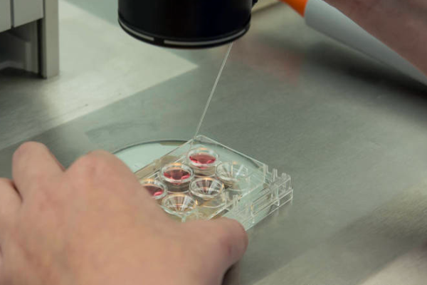 ae00f56d813fa36ddf61b6c550a24b03.png 试管婴儿的适应症有哪些