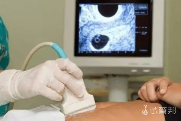 3d0542f9fe42c6e2590902f58be2fe72.png 揭秘生化妊娠的真凶