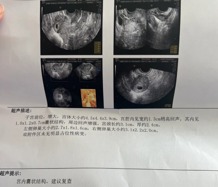 胎停前其实是有暗示信号的真的好不甘心