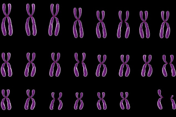 性染色体异常是不是父母遗传
