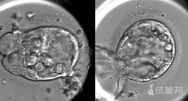 3e10dd9b3c9e27cdc3d1a42a01f5f595.png 胚胎移植后多少天着床