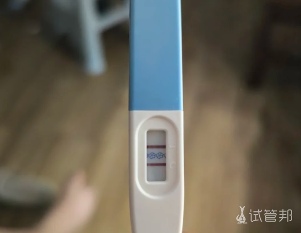 19d4a48ff8dc73b8c7237b6719fd15dc.png 做试管前一定要了解这5点