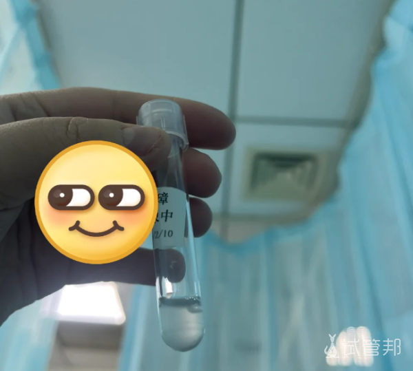 136de5abf602d03bf1f6c3311e9af021.png 人工授精结束