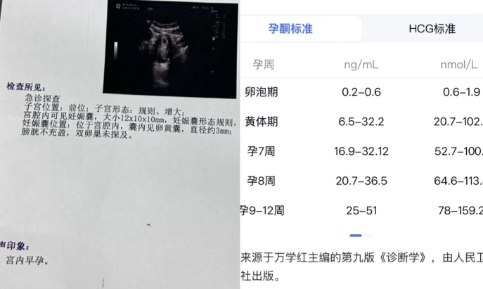 孕酮太低了宝宝没有保住
