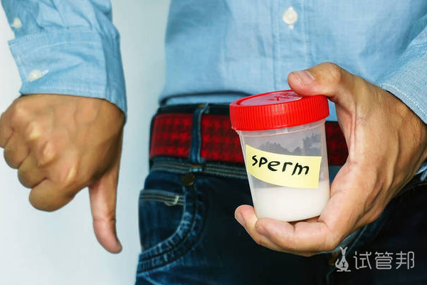 d5fc3736a0e8cb1fd31e4dd84856afbf.png 精子活力指的是什么