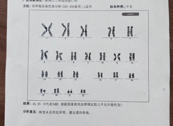 我的试管之路染色体异常检查两家医院结果大不同